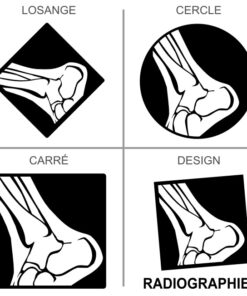 Sticker ou panneau Signalétique Recyclage - Radiographies médicales