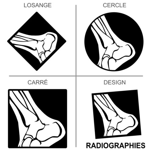 Sticker ou panneau Signalétique Recyclage - Radiographies médicales